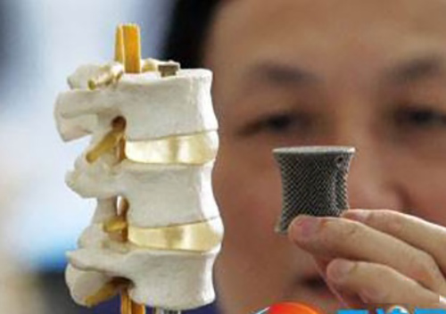 碳纤维医疗应用又有新尝试,碳纤维电极